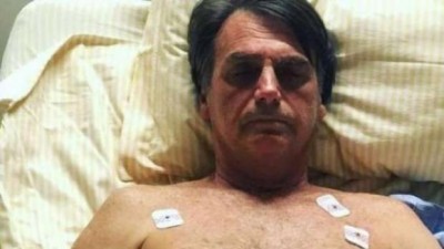 Bolsonaro recebe alta de UTI semi-intensiva em hospital de São Paulo