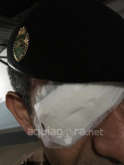 Três policiais militares ficam feridos ao serem atingidos por combustível em Marechal Rondon