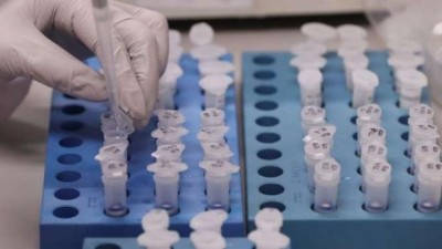 Número de casos do novo coronavírus sobe para 77