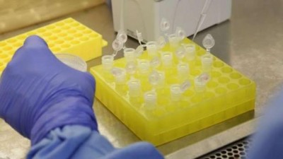 Cascavel confirma primeiro caso de coronavírus
