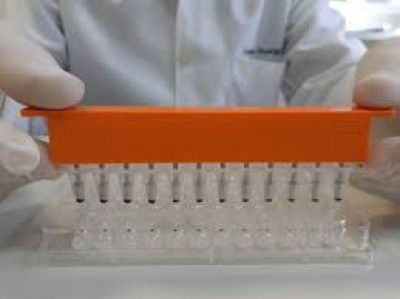 Estudo revela que teste rápido para Covid-19 criado na UFPR é mais preciso e rápido que padrão ouro