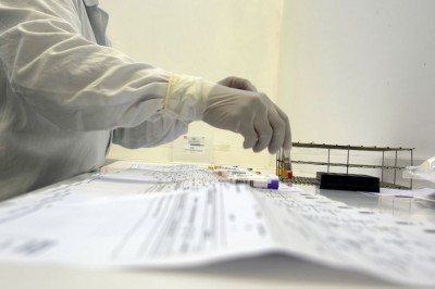 Saúde alerta para casos de doença rara que pode estar associada à Covid-19