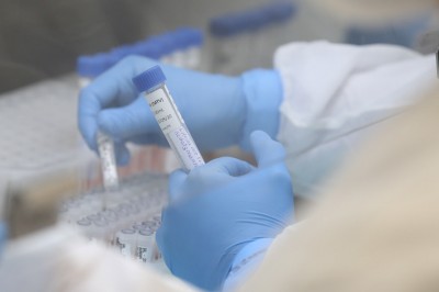 Paraná já registrou circulação de 24 variantes do coronavírus desde o começo da pandemia